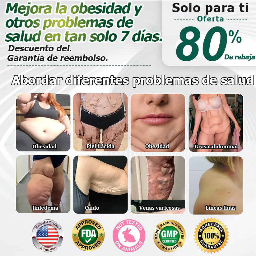 𝐑𝐞𝐜𝐨𝐦𝐞𝐧𝐝𝐚𝐝𝐨 𝐩𝐨𝐫 𝐌𝐚𝐲𝐨 𝐂𝐥𝐢𝐧𝐢𝐜 | 𝐓𝐢𝐞𝐧𝐝𝐚 𝐨𝐟𝐢𝐜𝐢𝐚𝐥 | 𝐂𝐲𝐞𝐫𝐚𝐨𝐥𝐦𝐝𝐞™ 𝐆𝐋𝐏-𝟏 𝐆𝐨𝐭𝐚𝐬 𝐫𝐞𝐠𝐮𝐥𝐚𝐝𝐨𝐫𝐚𝐬 𝐦𝐞𝐭𝐚𝐛ó𝐥𝐢𝐜𝐚𝐬 👨‍⚕️ 𝐎𝐛𝐞𝐬𝐢𝐝𝐚𝐝, 𝐞𝐧𝐟𝐞𝐫𝐦𝐞𝐝𝐚𝐝𝐞𝐬 𝐜𝐚𝐫𝐝𝐢𝐨𝐯𝐚𝐬𝐜𝐮𝐥𝐚𝐫𝐞𝐬, 𝐝𝐢𝐚𝐛𝐞𝐭𝐞𝐬, 𝐚𝐩𝐧𝐞𝐚 𝐝𝐞𝐥 𝐬𝐮𝐞ñ𝐨, 𝐩𝐫𝐨𝐛𝐥𝐞𝐦𝐚𝐬 𝐚𝐫𝐭𝐢𝐜𝐮𝐥𝐚𝐫𝐞𝐬 𝐲 𝐦á𝐬🌺